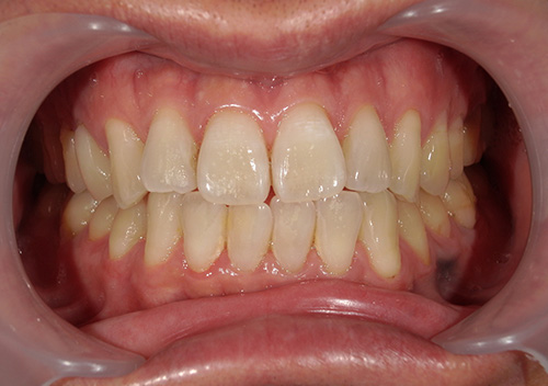 eclat white