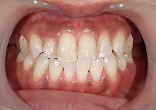 eclat white