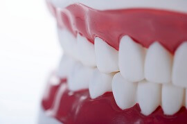 酸蝕歯の予防