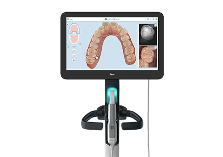 スキャンするだけで歯型取りができるからストレスフリー