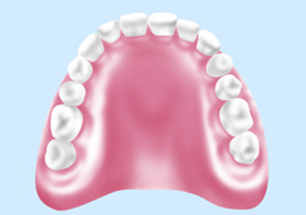 自費診療の入れ歯